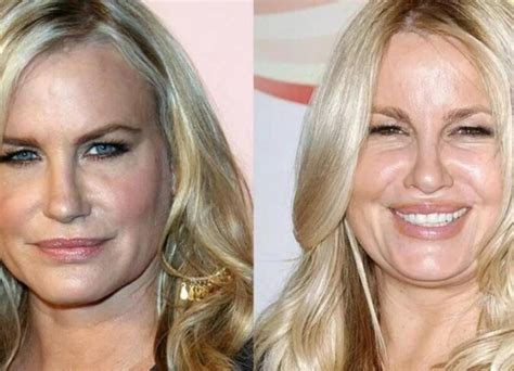 Jennifer Coolidge Before Plastic Surgery: The。